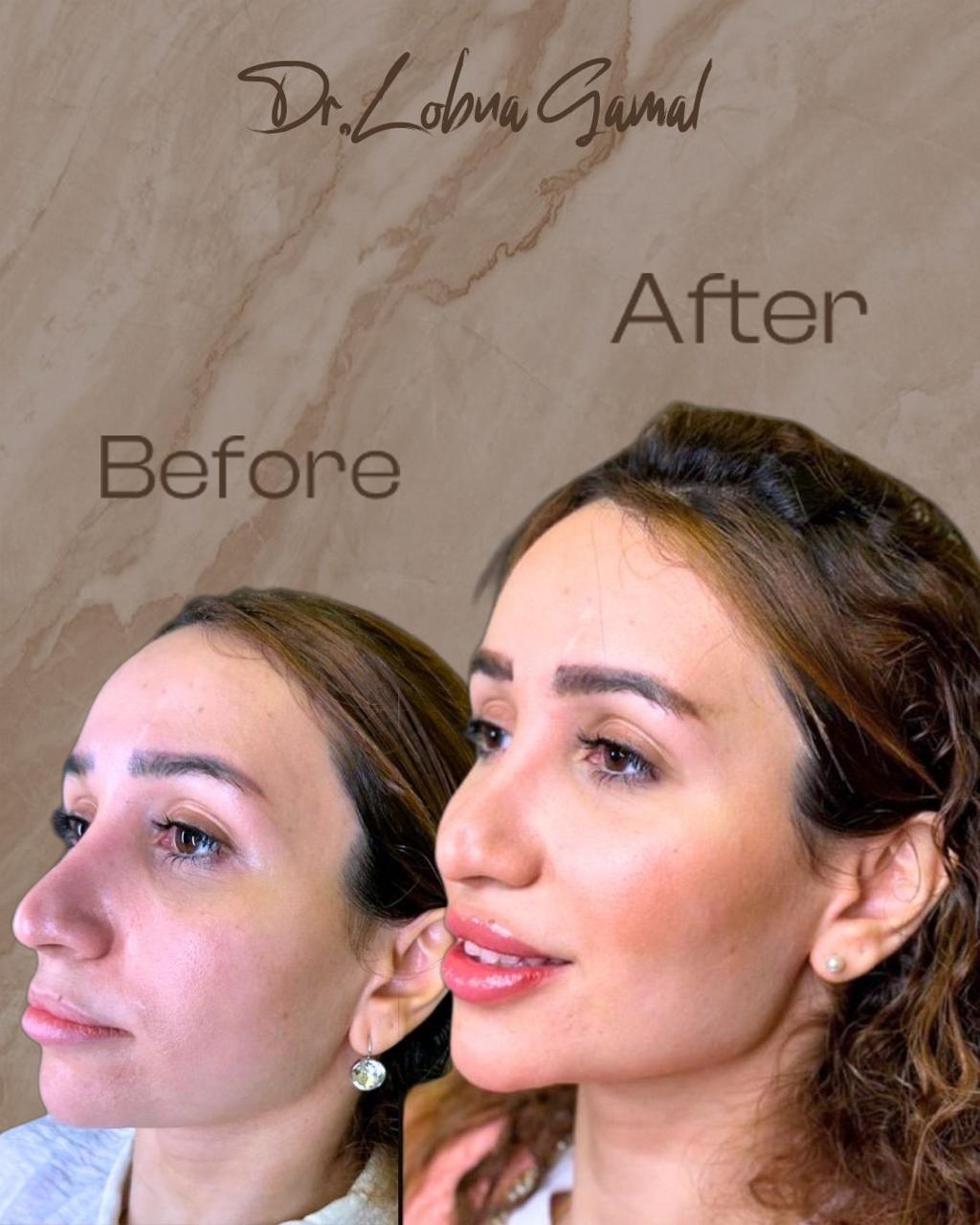 Treatment Result